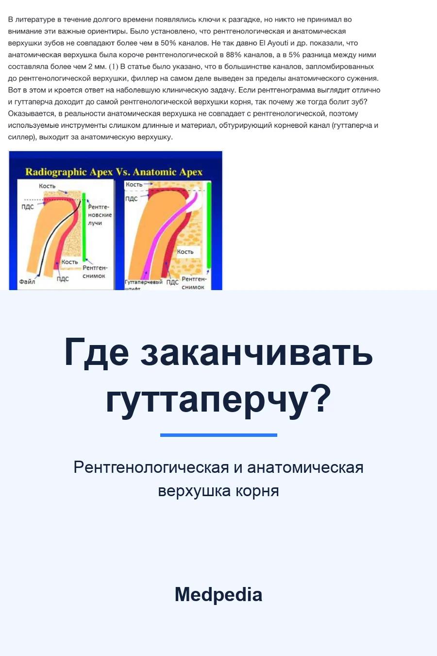 Обложка книги «Где заканчивать гуттаперчу?»
