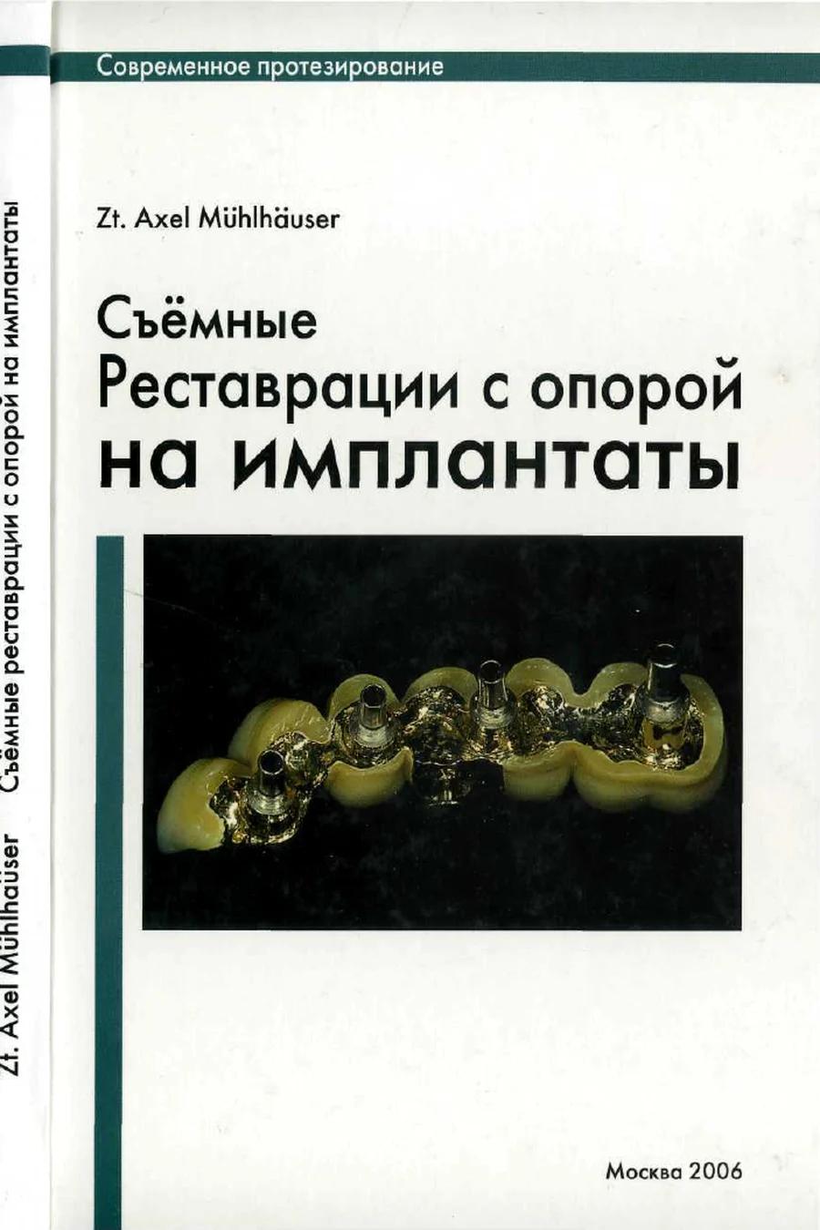 Обложка книги «Съёмные реставрации с опорой на имплантаты»