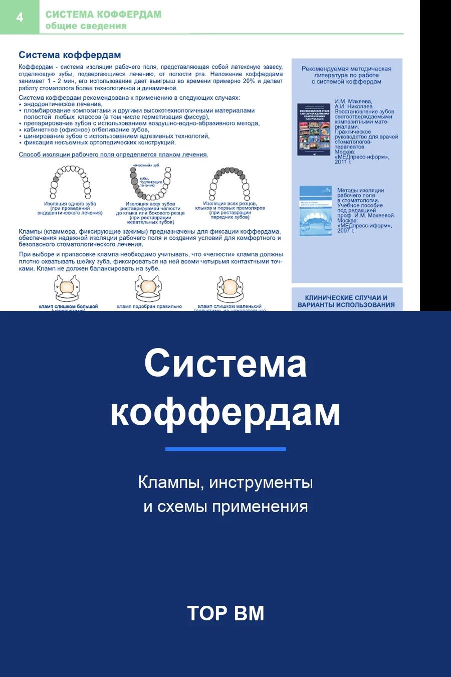 Обложка книги «Система коффердам»